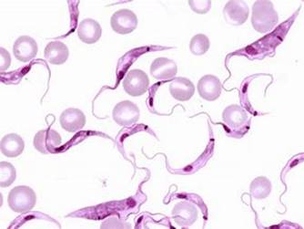 Image result for Trypanosoma