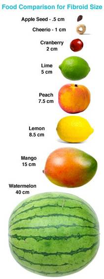 Image result for food comparison to fibroid size